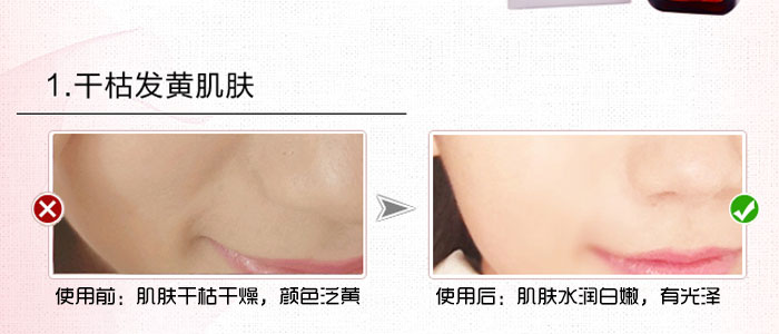 隆麗琦本草潤白修復(fù)霜套盒 隆麗琦本草潤白修復(fù)霜套盒