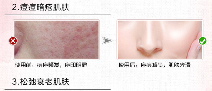 隆麗琦本草潤白修復(fù)霜套盒 隆麗琦本草潤白修復(fù)霜套盒